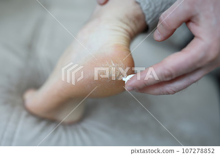 Part of human body 107278852