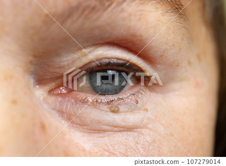 Charming lady and facial picture 107279014