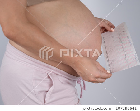 Pregnant woman with bare belly holding Cardiotocography results.  107290641
