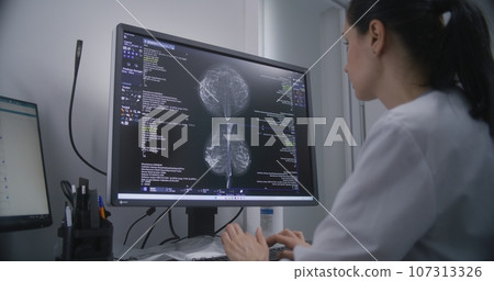 Female doctor examines results of mammography on computer 107313326