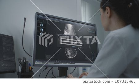 Female doctor examines results of mammography on computer 107313463