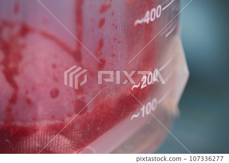 Close-up view of blood loss in surgical vaccum during surgery 107336277