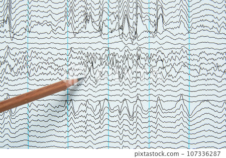 Imaging of electroencephalography recording of human Imaging of electroencephalography recording of human 107336287