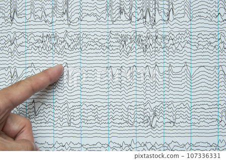 Pointing at imaging of human electroencephalography recording Pointing at imaging of human electroencephalography recording 107336331