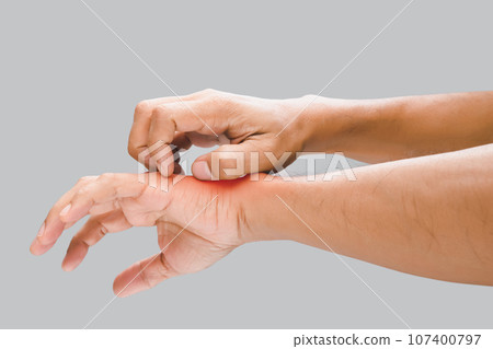 Have a itching Have a itching 107400797