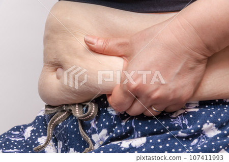 [Debeso with a housewife who picks belly meat] 107411993