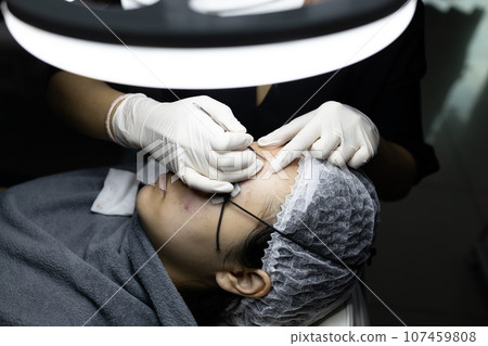 Hands of Dermatologist cleansing blackhead,removing acne pimples with pimple remover tool,asian teenage lady girl extracting inflammatory acne spot on face in clinic,facial treatment,skin care concept 107459808