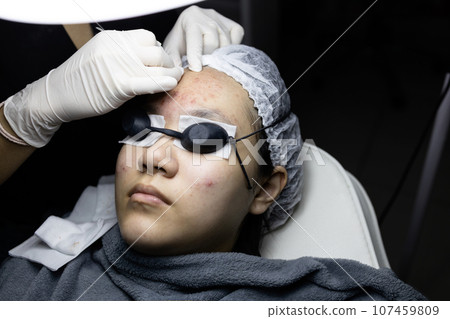 Young woman lying on bed doing facial skin care,pimple extraction,blackhead removal,teenage girl treating zit on her face and nose,facial acne treatment with Dermatologist,skincare and beauty concept Young woman lying on bed doing facial skin care,pimple extraction,blackhead removal,teenage girl treating zit on her face and nose,facial acne treatment with Dermatologist,skincare and beauty concept 107459809