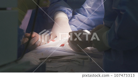 Medics stitch wound and finish operation. Close up of operation 107473313