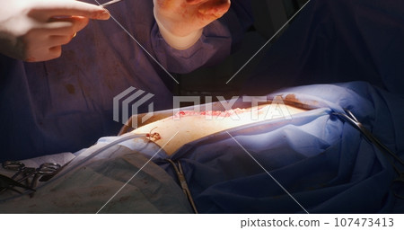 Professional surgeon stitches cut using medical clip and tweezers 107473413