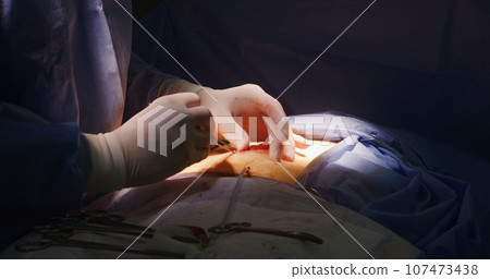 Professional surgeon stitches cut using medical clip and tweezers 107473438