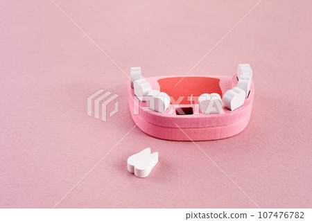 Teeth loss concept. Wooden jaw model with missing or extracted tooth 107476782