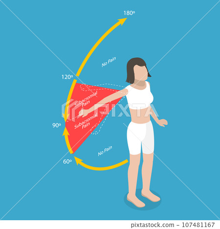 3D Isometric Flat Vector Conceptual Illustration of Painful Arc Test 107481167