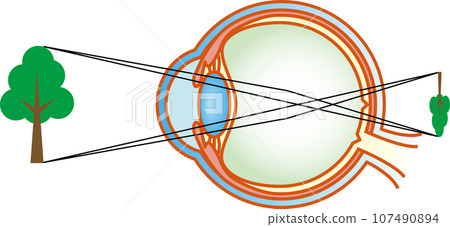 遠視 眼睛結構 107490894