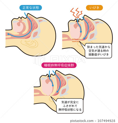 Illustration explaining breathing during sleep 107494928
