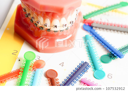 Orthodontic ligatures rings and ties, elastic rubber bands on orthodontic braces, model for dentist studying about dentistry. 107532912