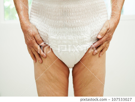 Asian senior woman patient wearing adult incontinence diaper pad in hospital. Asian senior woman patient wearing adult incontinence diaper pad in hospital. 107533027