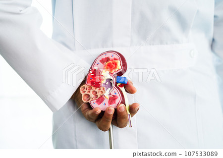 Chronic kidney disease, doctor holding model for treatment urinary system, urology, Estimated glomerular filtration rate eGFR. 107533089
