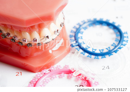 Orthodontic ligatures rings and ties, elastic rubber bands on orthodontic braces, model for dentist studying about dentistry. Orthodontic ligatures rings and ties, elastic rubber bands on orthodontic braces, model for dentist studying about dentistry. 107533127