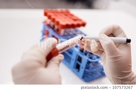 Label, scientist or hands writing on blood test tube, DNA or science experiment in laboratory. Closeup, hepatitis or person with study sample or research for biology innovation or medical results 107573267