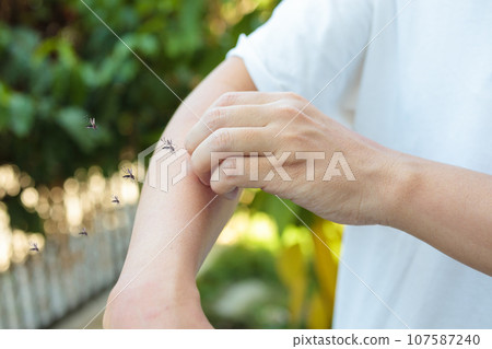 Man itching and scratching on arm from allergy skin rash cause by Mosquitoes bite Man itching and scratching on arm from allergy skin rash cause by Mosquitoes bite 107587240