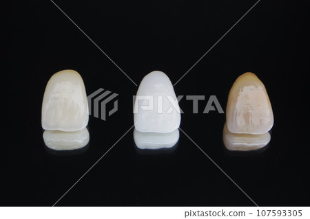 front tooth ceramic crown front tooth ceramic crown 107593305