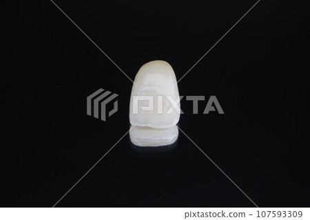 前牙陶瓷冠 前牙陶瓷冠 107593309