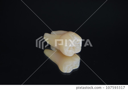 lower molar ceramic inlay lower molar ceramic inlay 107593317