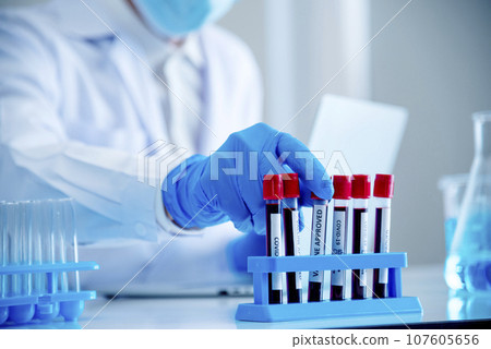 Close up Scientist man hands holding sample blood test tube science laboratory. Doctor clinic healthcare technician lab testing blood sample diagnosis. Crop man scientist hands testing medical lab Close up Scientist man hands holding sample blood test tube science laboratory. Doctor clinic healthcare technician lab testing blood sample diagnosis. Crop man scientist hands testing medical lab 107605656