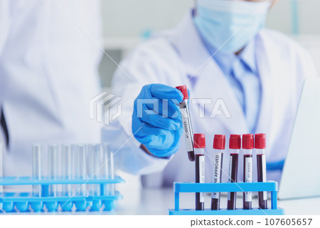 Close up Scientist man hands holding sample blood test tube science laboratory. Doctor clinic healthcare technician lab testing blood sample diagnosis. Crop man scientist hands testing medical lab Close up Scientist man hands holding sample blood test tube science laboratory. Doctor clinic healthcare technician lab testing blood sample diagnosis. Crop man scientist hands testing medical lab 107605657