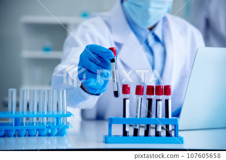 Close up Doctor clinic healthcare technician lab testing blood sample diagnosis. Crop man scientist hands testing medical lab. Scientist man hands holding sample blood test tube science laboratory. Close up Doctor clinic healthcare technician lab testing blood sample diagnosis. Crop man scientist hands testing medical lab. Scientist man hands holding sample blood test tube science laboratory. 107605658