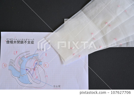 二尖瓣逆流心臟病片狗檢查醫院就診 107627706