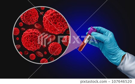 Blood Cancer Screening Blood Cancer Screening 107646520