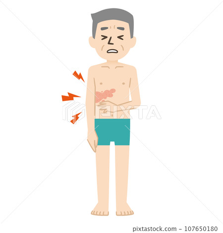 表達帶狀皰疹的皮疹和疼痛的插圖 表達帶狀皰疹的皮疹和疼痛的插圖 107650180