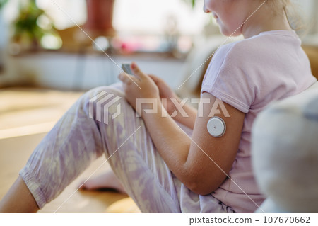 Diabetic girl with continuous glucose monitor on arm. The CGM device makes the life of schoolgirl easier, helping manage illness and focus on other activities. 107670662
