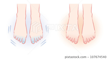 Feet that are sensitive to cold. Illustration of warm feet before and after. 107674540