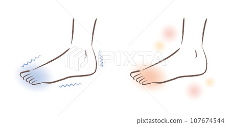 Feet that are sensitive to cold. Illustration of warm feet before and after. 107674544