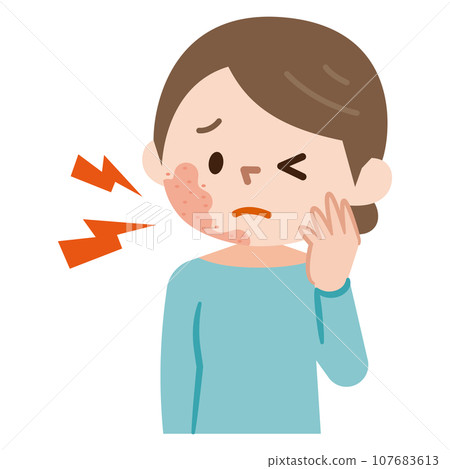 帶狀皰疹症狀圖 帶狀皰疹症狀圖 107683613