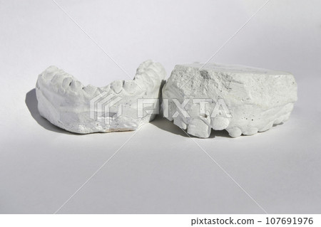 Dental casting gypsum model plaster cast stomatologic human jaws prothetic laboratory. High quality photo Dental casting gypsum model plaster cast stomatologic human jaws prothetic laboratory. High quality photo 107691976