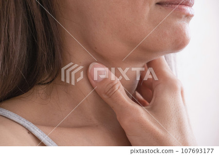 Cervical lymphadenitis of the right side in a woman 107693177