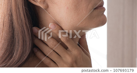Cervical lymphadenitis of the right side in a woman Cervical lymphadenitis of the right side in a woman 107693179