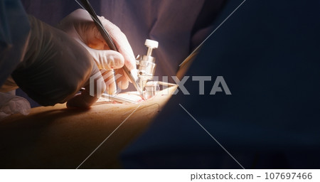 Doctor sews up cut with medical thread and finishes surgery 107697466