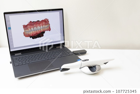 3D Scanned Picture of Scanned Teeth on Monitor of Computer, Notebook. White 3d Intraoral Dental Tooth Scanner Lying on Table. Copy Space. Dental Equipment, Device For Scanning Teeth. Horizontal 3D Scanned Picture of Scanned Teeth on Monitor of Computer, Notebook. White 3d Intraoral Dental Tooth Scanner Lying on Table. Copy Space. Dental Equipment, Device For Scanning Teeth. Horizontal 107725345