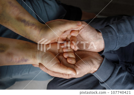 Human hand with bruises in other human hand. Supporting victims of domestic violence. 107740421
