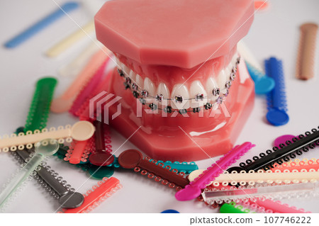 Orthodontic ligatures rings and ties, elastic rubber bands on orthodontic braces, model for dentist studying about dentistry. Orthodontic ligatures rings and ties, elastic rubber bands on orthodontic braces, model for dentist studying about dentistry. 107746222