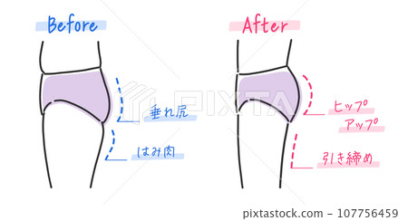 下垂屁股和美臀對比插畫素材 下垂屁股和美臀對比插畫素材 107756459
