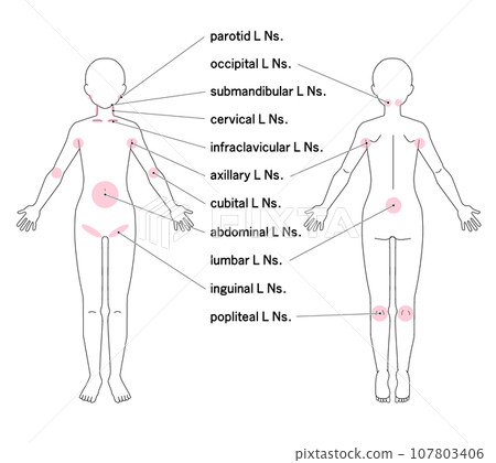 Location of major lymph nodes throughout the body Location of major lymph nodes throughout the body 107803406