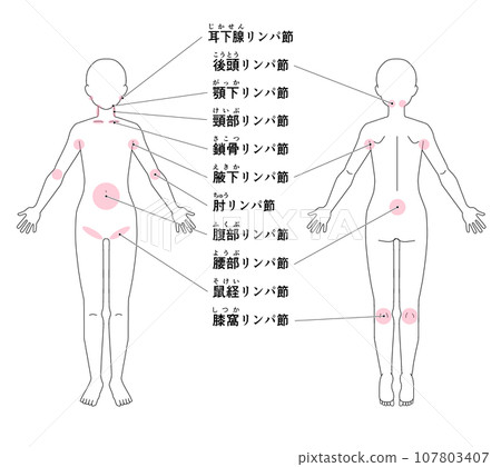 Location of major lymph nodes throughout the body Location of major lymph nodes throughout the body 107803407