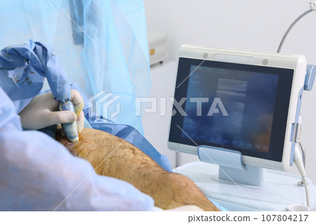 Medical surgery for endovenous laser photocoagulation of the great saphenous vein. Miniphlegectomy. Endovenous laser coagulation vein. Medical surgery for endovenous laser photocoagulation of the great saphenous vein. Miniphlegectomy. Endovenous laser coagulation vein. 107804217