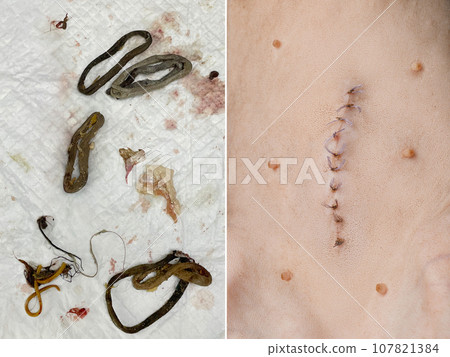 Cat Intestinal Blockage. Intestinal contents and suture scar closeup 107821384